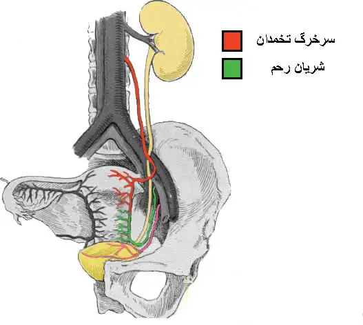 تنگی اتصال حالب
